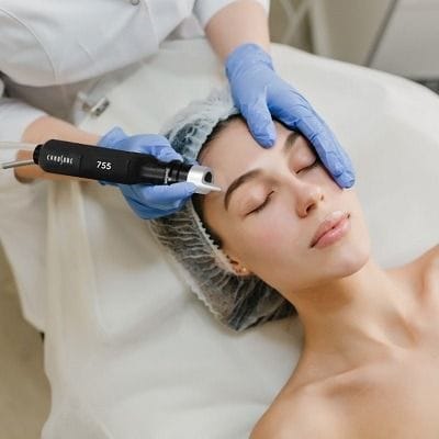 Does Pico Laser Remove Dark Spots? 1 Does Pico Laser Remove Dark Spots?