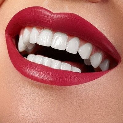 Emax dental crowns dental veneers for 1399 AED