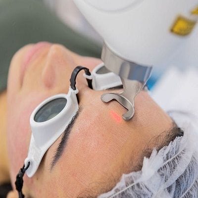 Experience the Power of Fotona 4D for Facial Renewal Dubai