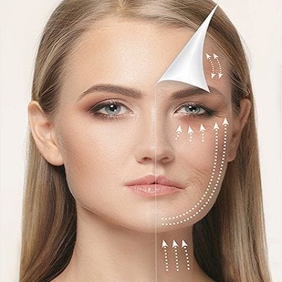 Best Treatment in 2023 for Fine Lines and Facial Wrinkles in Dubai 1 Fine Lines and Wrinkles Can be Treatment Permanently