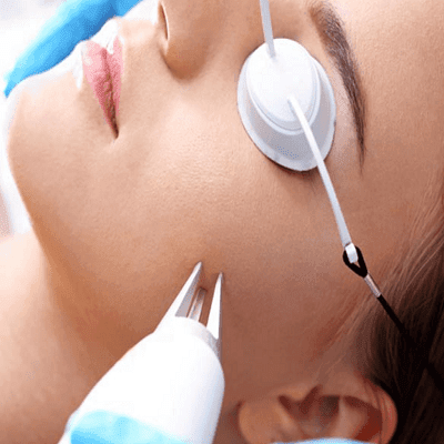 Fractional CO2 Laser Skin Resurfacing just got Cooler!
