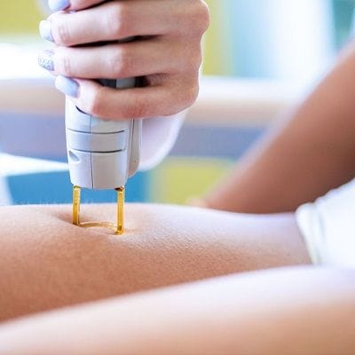 Full Legs Laser Hair Removal Cost