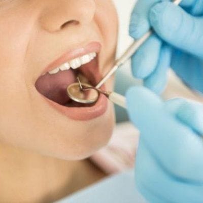 Full Mouth Rehabilitation Cost in Dubai
