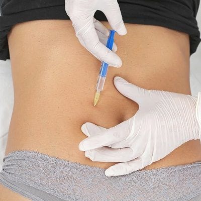 Gastric Botox Injection for Weight Loss