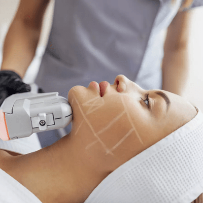 HIFU Treatment Cost in Dubai