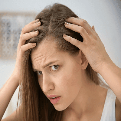 Hair Fall Reasons In Females