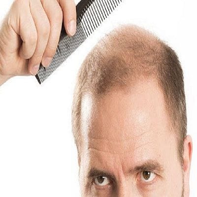 Hair Implant Cost in Dubai 1 Hair Implants in Dubai, Abu Dhabi & Sharjah Cost Price