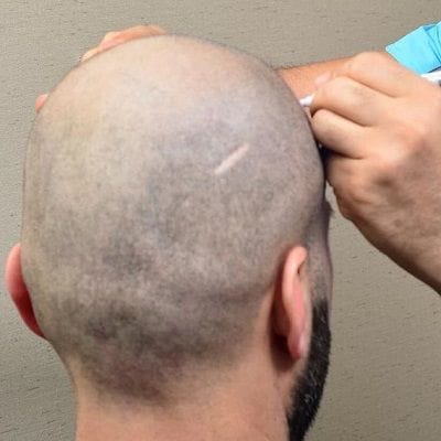 Hair Specialist Doctor in Dubai 1 Hair Specialist Doctor in Dubai, Abu Dhabi & Sharjah Cost