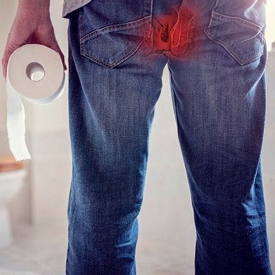 Hemorrhoid Surgery Cost in Dubai & Abu Dhabi