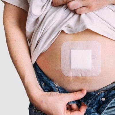 Hernia Surgery in Dubai, Abu Dhabi & Sharjah