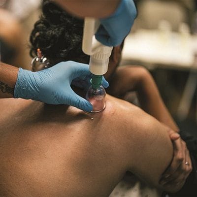 Hijama For Cholesterol In Dubai 1 Hijama For Cholesterol In Dubai & abu dhabii