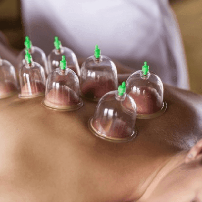 Hijama Therapy Cost In Dubai 1 Hijama Therapy Cost In Dubai