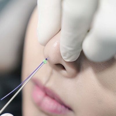 Hiko Nose Thread Lift Price