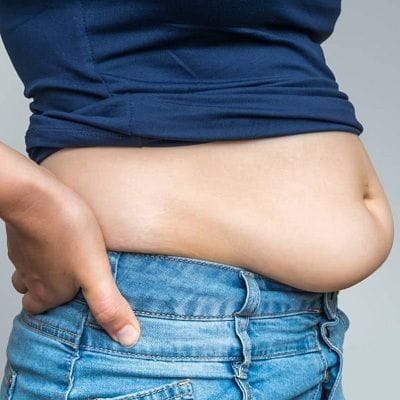 How Can I Get Rid of a Tummy Without Surgery