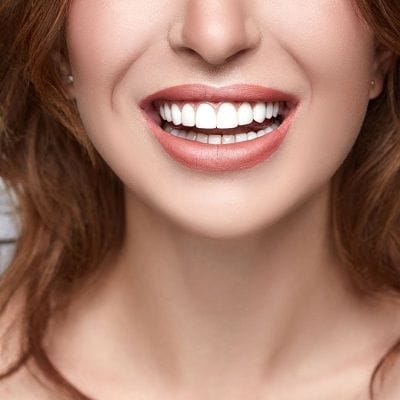 How Does Digital Smile Design Work digital smile