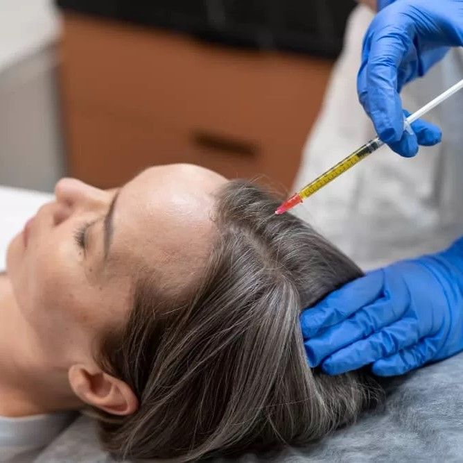 How Effective is Exosome Treatment for Thinning Hair? 1 How Effective is Exosome Treatment for Thinning Hair