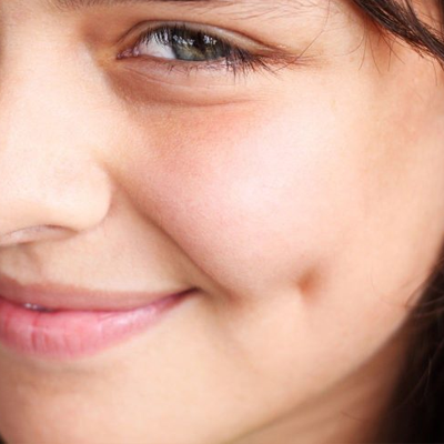How Long Do Surgical Dimples Last? 1 How Long Do Surgical Dimples Last?
