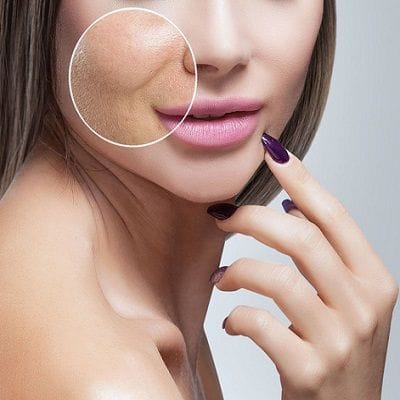How Long Does It Take to Heal from Pico Laser? 1 How Long Does It Take to Heal from Pico Laser?