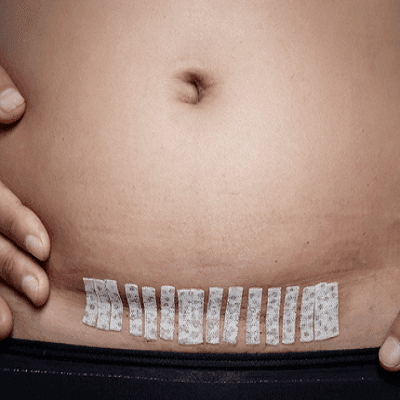 How Much Does A Hysterectomy Cost in Dubai