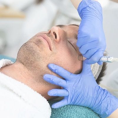 How Much Does Microdermabrasion Cost