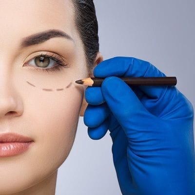 How Much Does Under-Eye Blepharoplasty Cost in Dubai