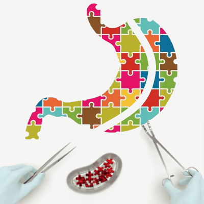 How Much Is Gastric Bypass Surgery In Dubai