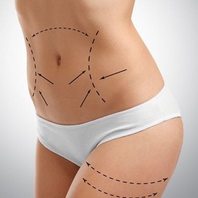 How Much Vaser Liposuction Cost