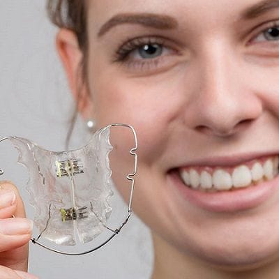 How Removable Appliances Are Transforming Smiles