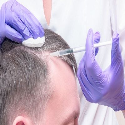 How To Regrow Hair on a Bald Spot Fast in Dubai? 1 How To Regrow Hair on a Bald Spot Fast in Dubai, Abu Dhabi Cost