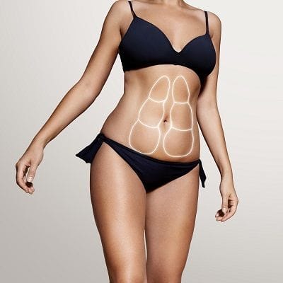 How Tummy Tuck Transform Loose Skin Effectively 1 How Tummy Tuck Transform Loose Skin Effectively