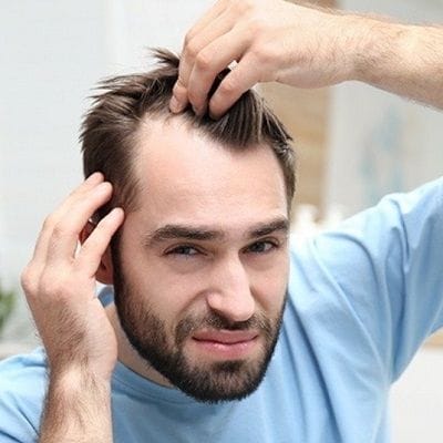 How can I Regrow my Frontal Hairline? 1 How can I Regrow my Frontal Hairline?