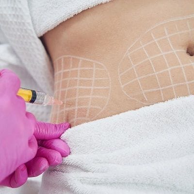 How much Fat can you Lose with Fat Melting Injections? 1 How much Fat can you Lose with Fat Melting Injections?