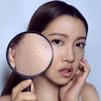 How to Get Rid of Dark Spots on Dark Skin Dubai & Abu Dhabi