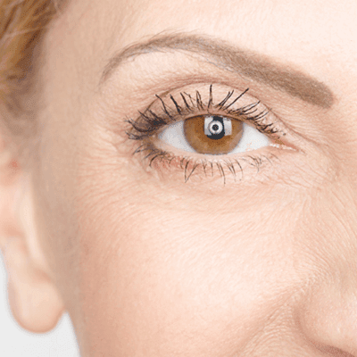 How to Tighten Eyelid Skin Without Surgery? 1 How to Tighten Eyelid Skin Without Surgery