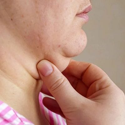 How to permanently fix Your Double Chin? 1 How to permanently fix Your Double Chin?