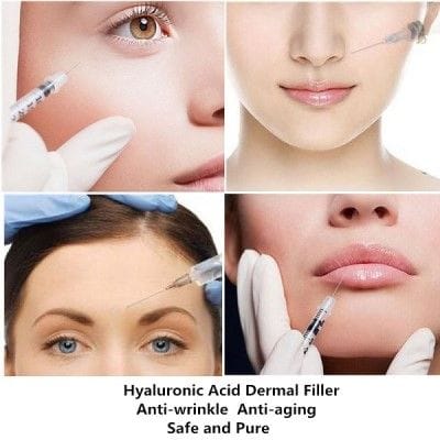 What Should You Know Hyaluronic Acid Fillers?