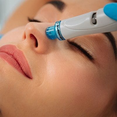 Hydra Facial for Acne Prone Skin