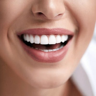 Hydrogen Peroxide Teeth Whitening Cost