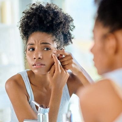 Hyperpigmentation Treatment for Black Skin 1 Hyperpigmentation Treatment for Black Skin