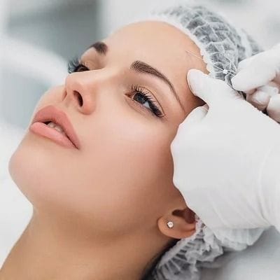 Improve Smile Lines with Nano Thread Lifts 1 Improve Smile lines with Nano Thread Lifts