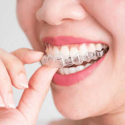 Invisalign Braces Treatment