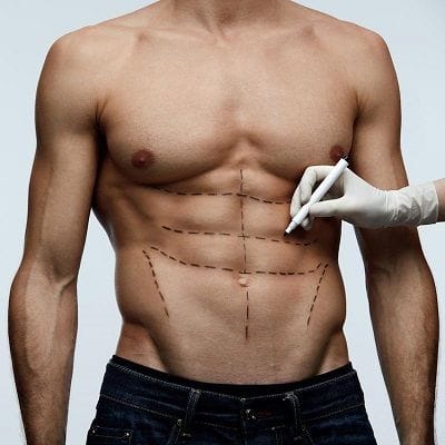Is Liposuction Haram In Islam?
