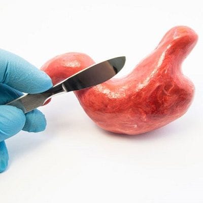 Is Bariatric Surgery Available in Dubai UAE? 1 Is bariatric surgery available in Dubai UAE | Enfield Royal Clinic