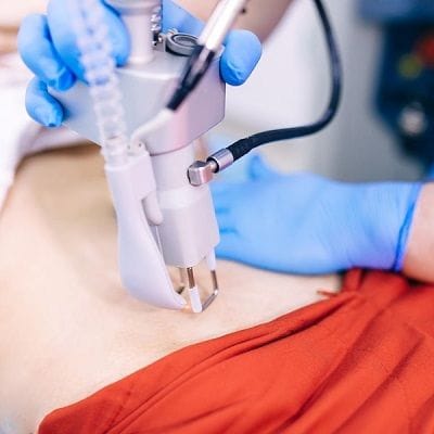 Is Laser Treatment Good for kidney Stones? 1 Is laser treatment good for kidney stones?