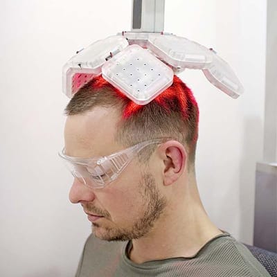 Laser Treatment For Hair Growth