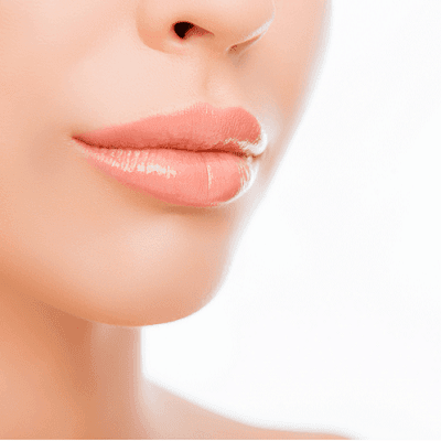 Lip Lift Without Scar