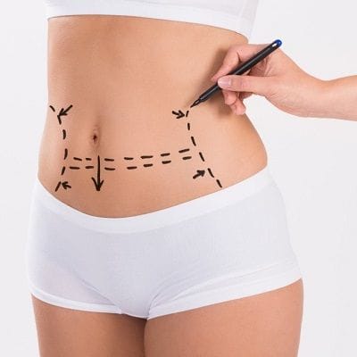 Lipo Abdominoplasty Cost in Dubai | Price & Deals