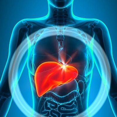 Liver Cirrhosis Treatment in Dubai