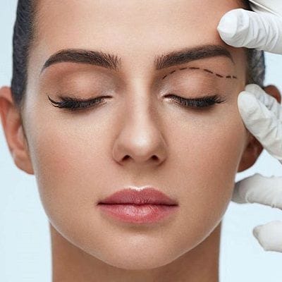 Make your Eyes Younger with Blepharoplasty 1 Make your Eyes Younger With Blepharoplasty
