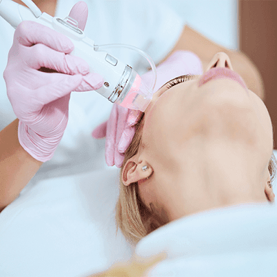 Microneedling For Scars: How Does It Work With RF? 1 Microneedling For Scars How Does It Work With RF
